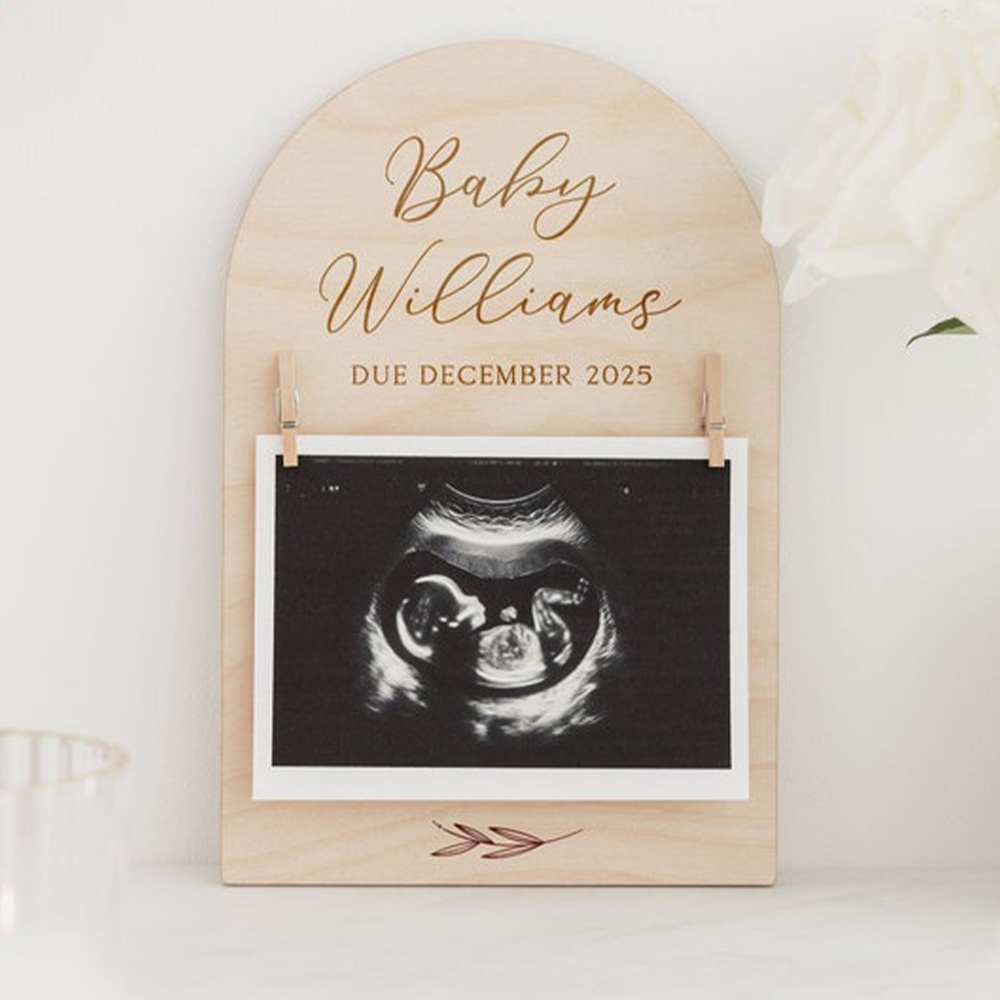Cartello personalizzato per l' - Photo Frame Baby recensione e prezzo